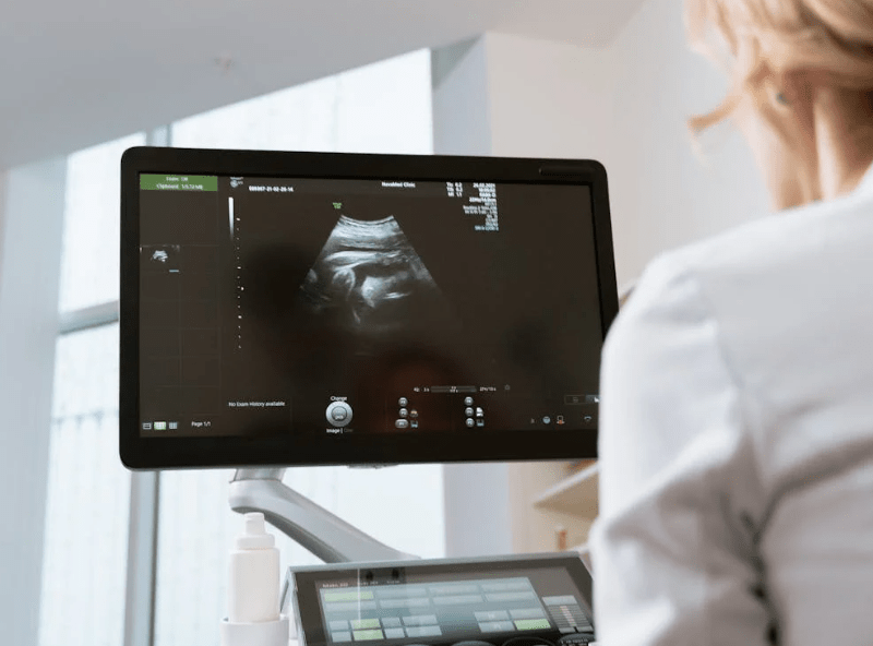 view over shoulder of doctor looking at a sonogram on a screen