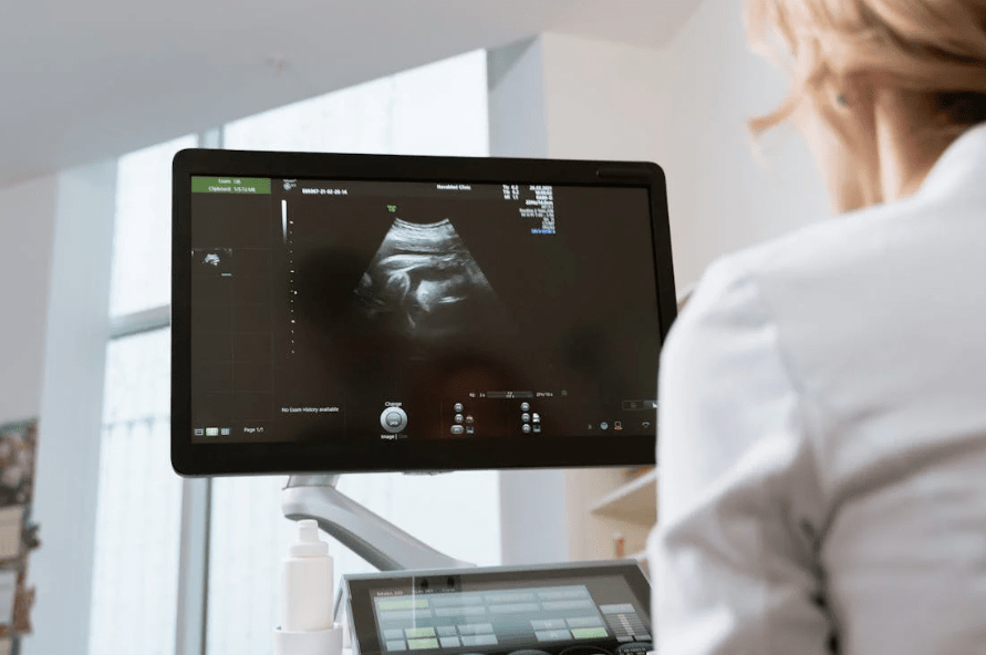 view over shoulder of doctor looking at a sonogram on a screen